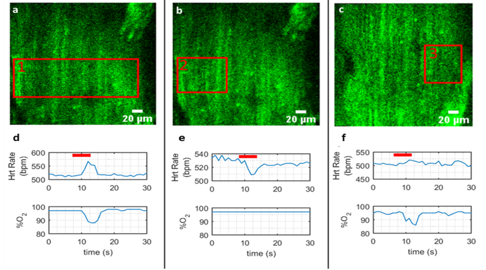 Spatially selective photo-stimulation