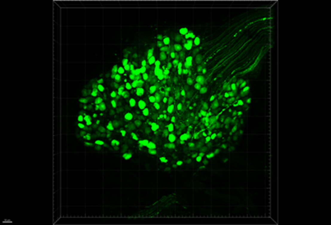 DRG cell bodies and axons expressing GFP