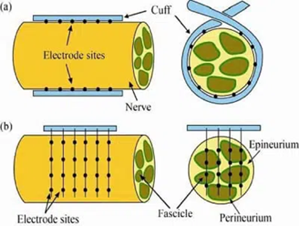 Electrical nerve cuff and nerve array schematic