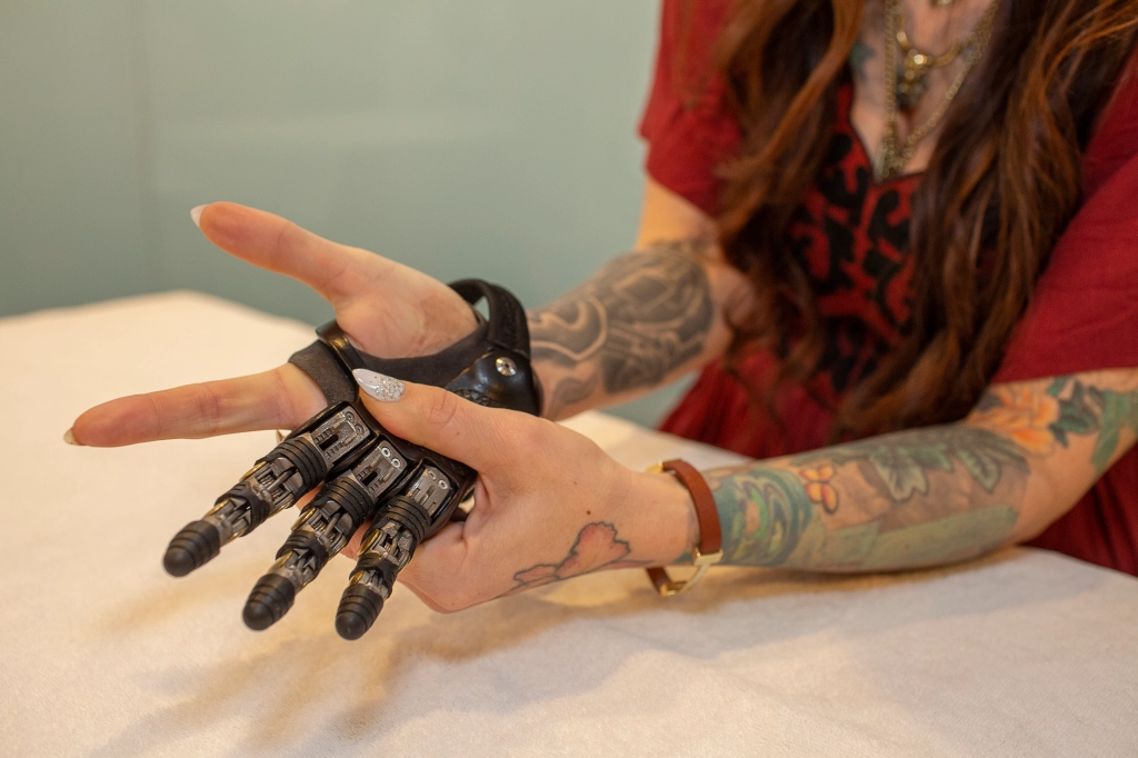 User donning a prosthesis with point digits from Point Designs.