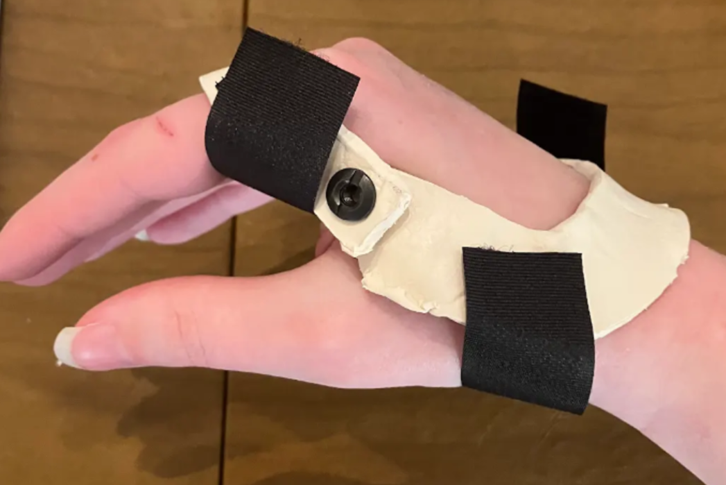 Anti-Claw design prototype for bracial plexus injury